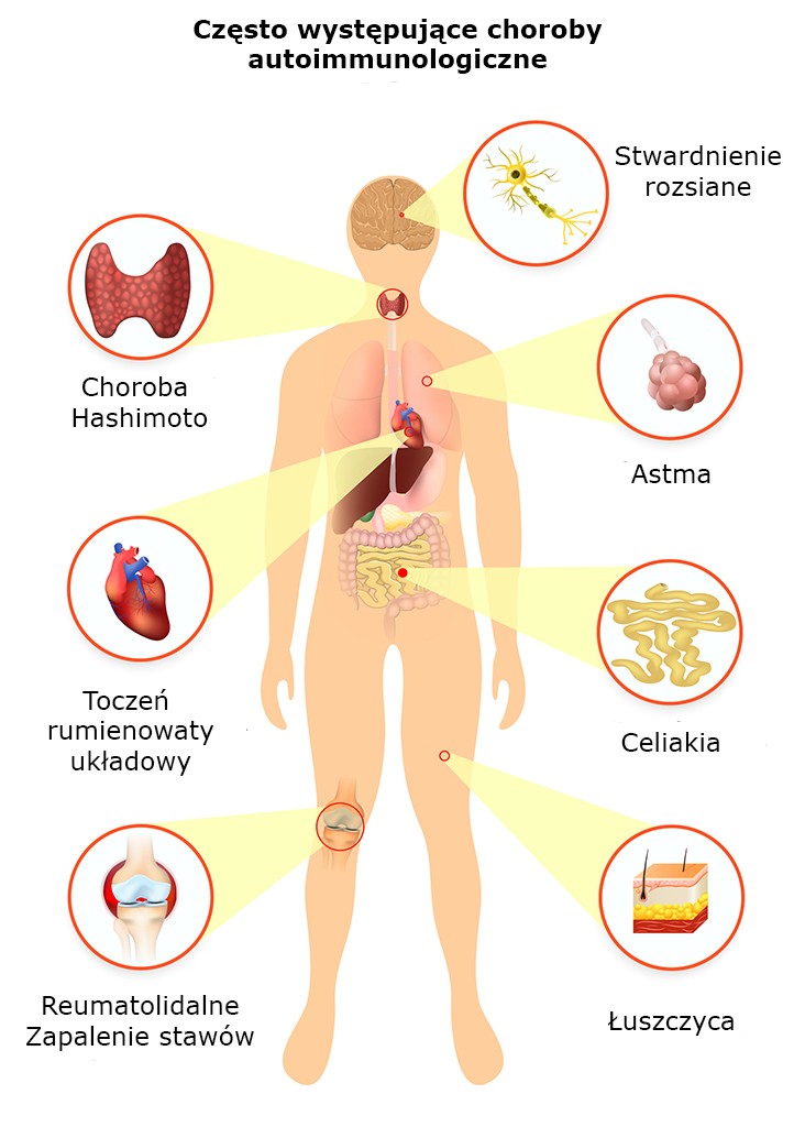 immunolog warszawa