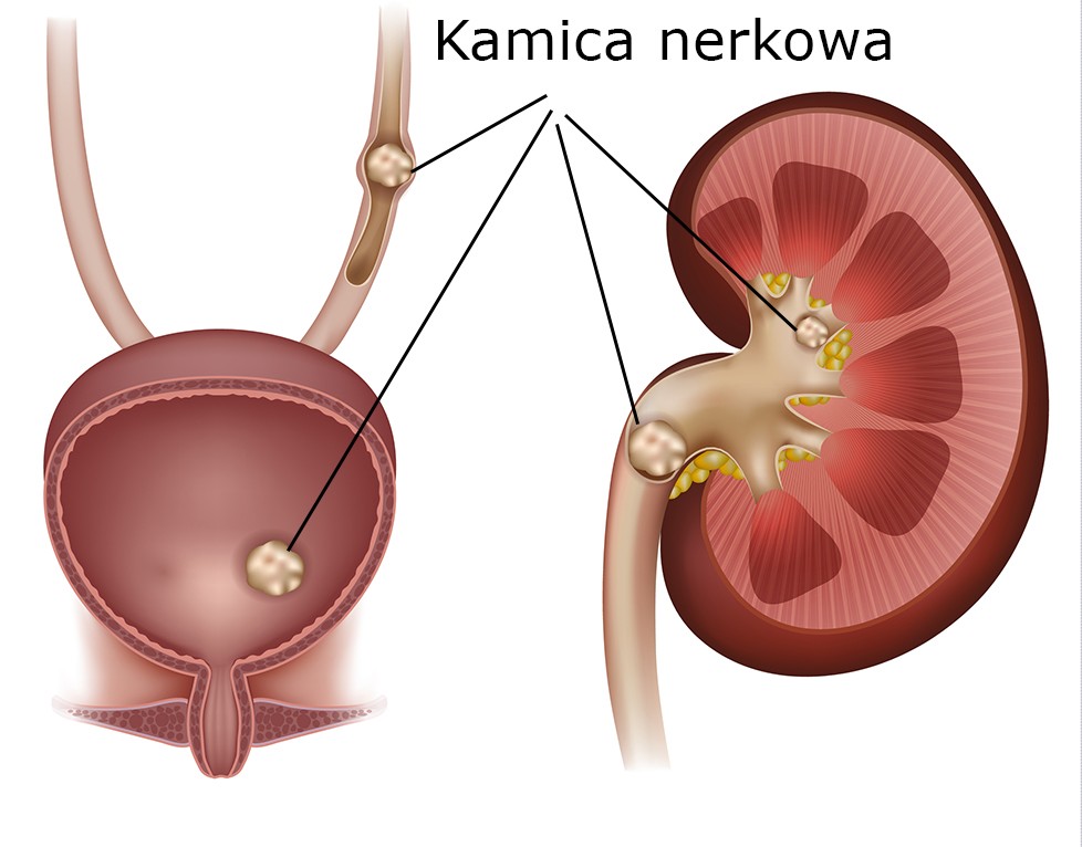 kamica