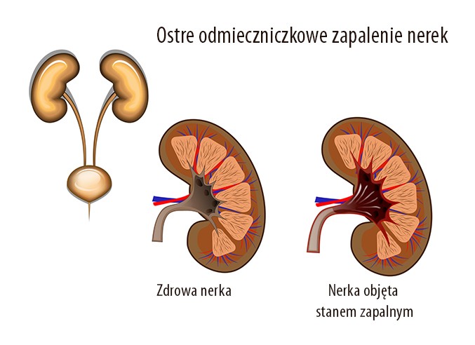 urolog warszawa