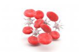 Anemia - przyczyny, objawy, leczenie 
