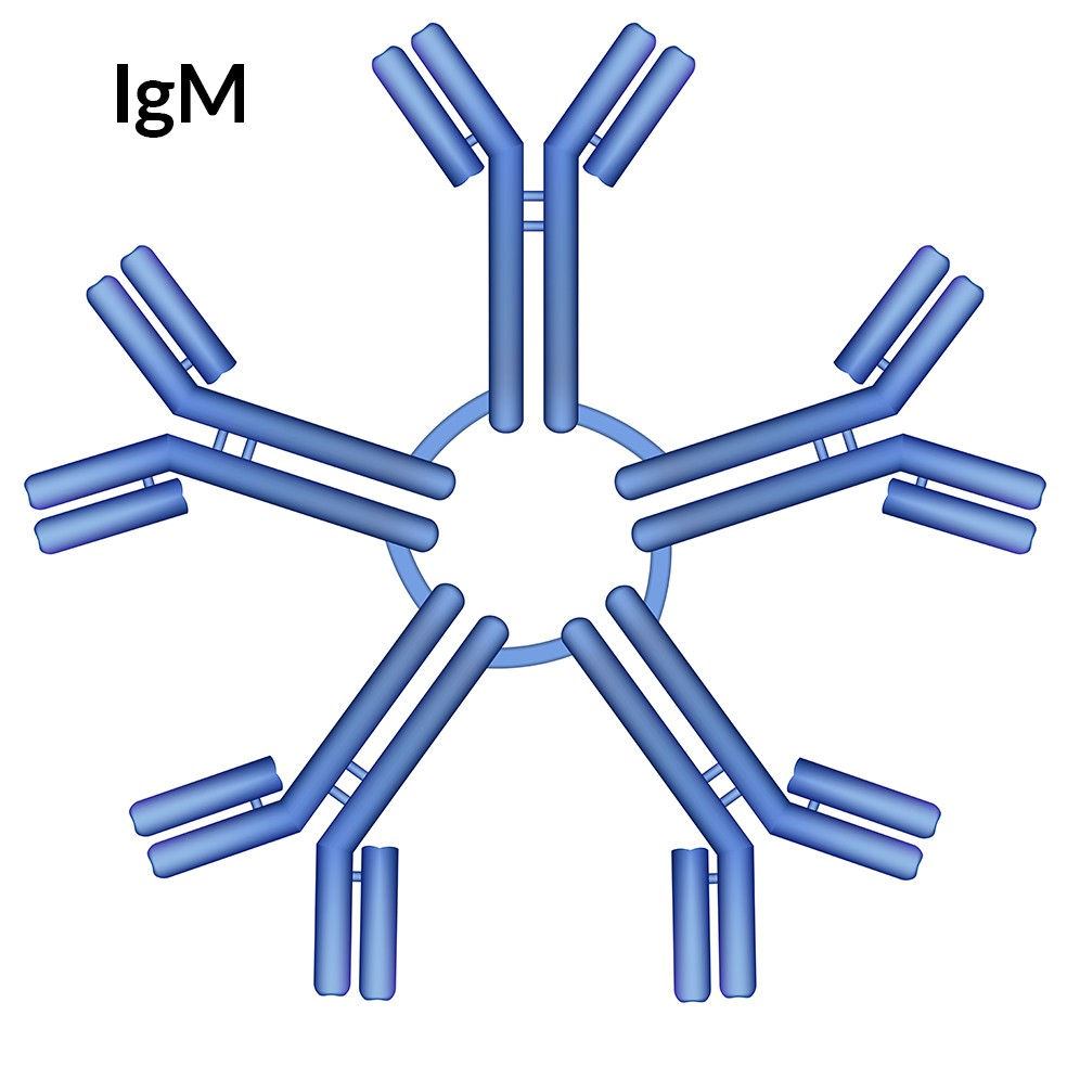 Igm