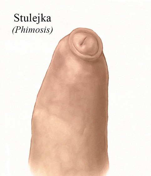 stulekka