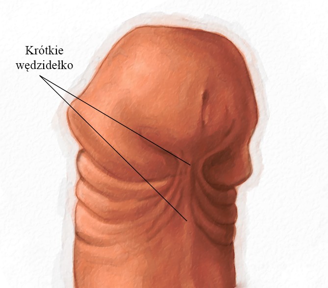 krotkie wedzidelko